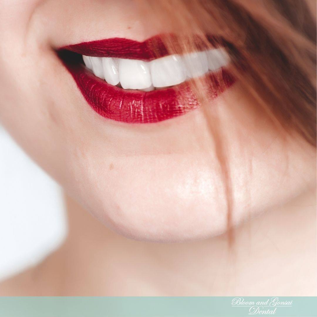 There are four main types of teeth... - Bloom and Gonsai | Facebook