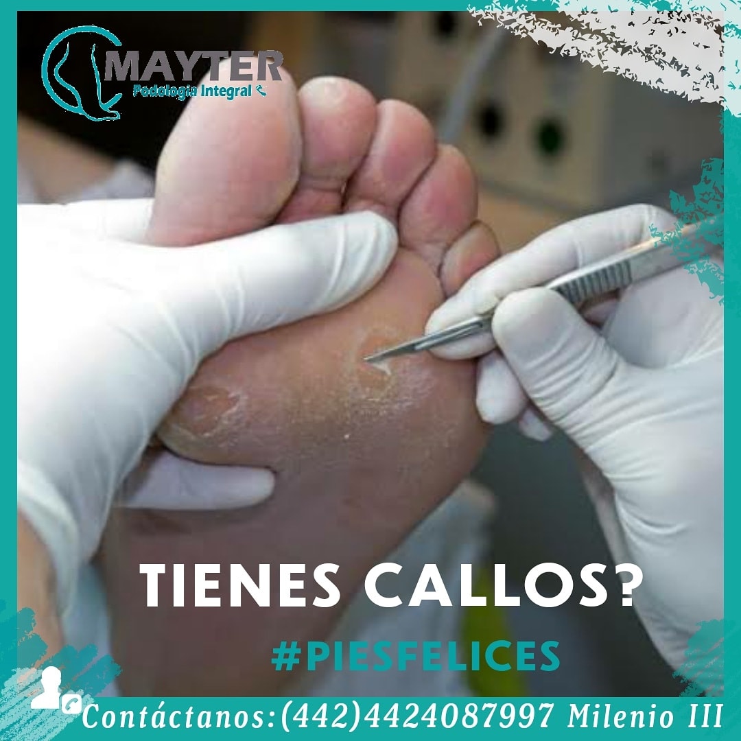 Conoces... - Podologia Integral Mayter Enfermera y Podologa