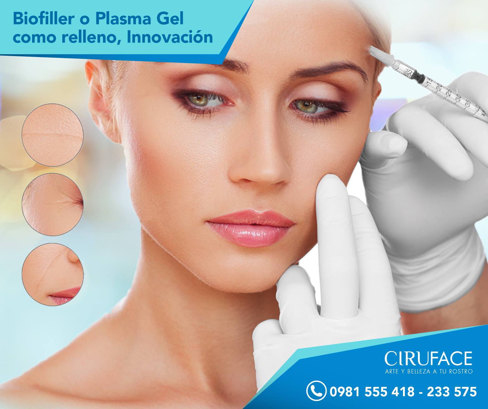 El Biofiller o plasma gel... - CIRUFACE - Dr. Juan Cabral | Facebook