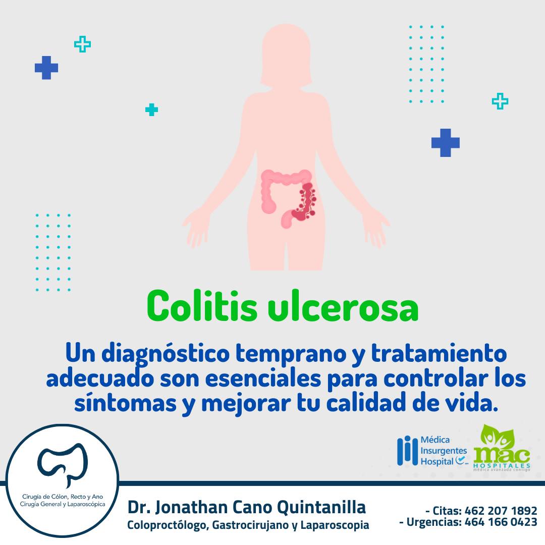 La colitis ulcerosa es una enfermedad inflamatoria crónica que afecta ...