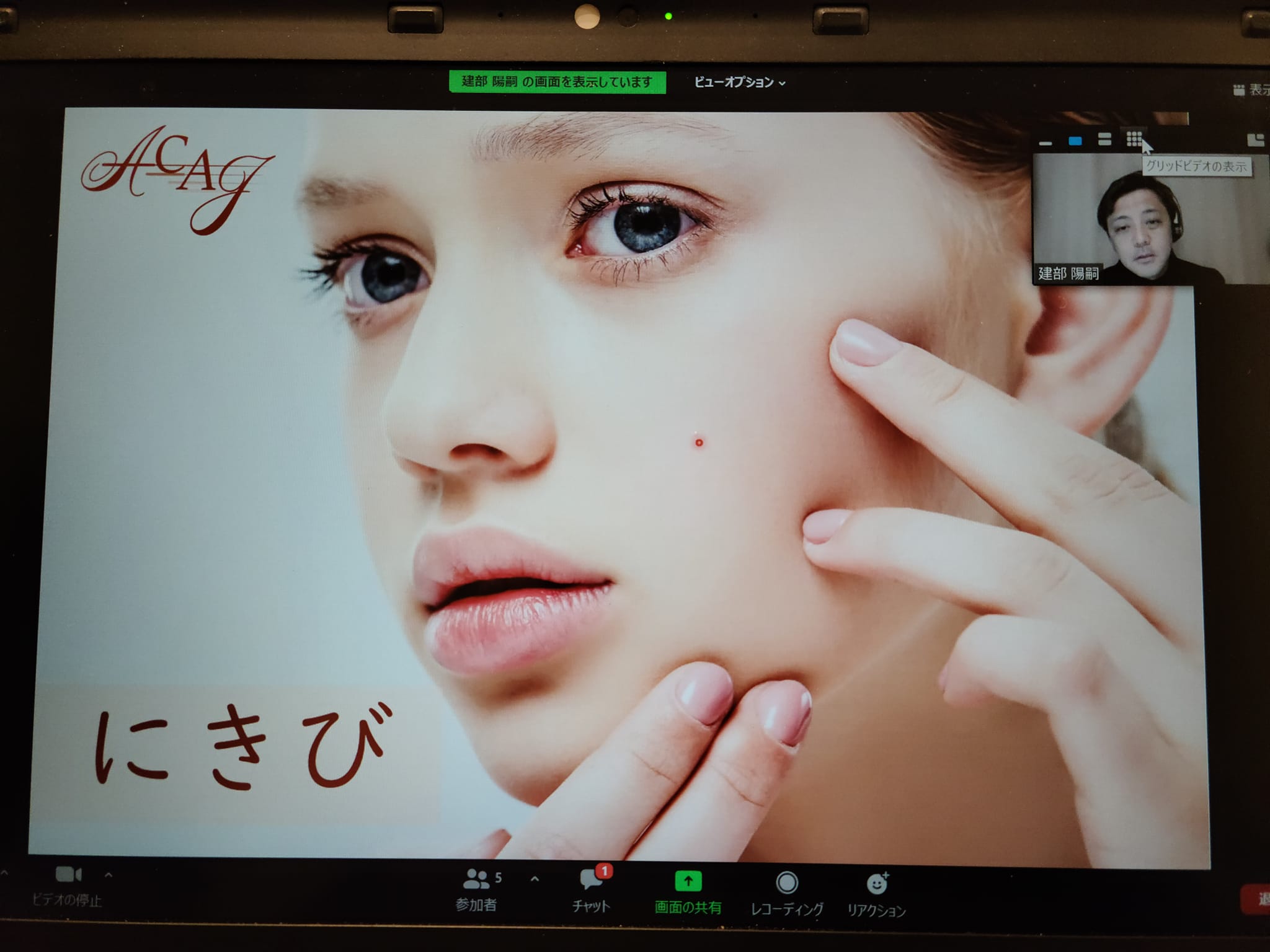 ACAJ - 会員様向けの月1セミナーが開催されました！ 今回のテーマは…『ニキビ』 こんなこと話してます！...