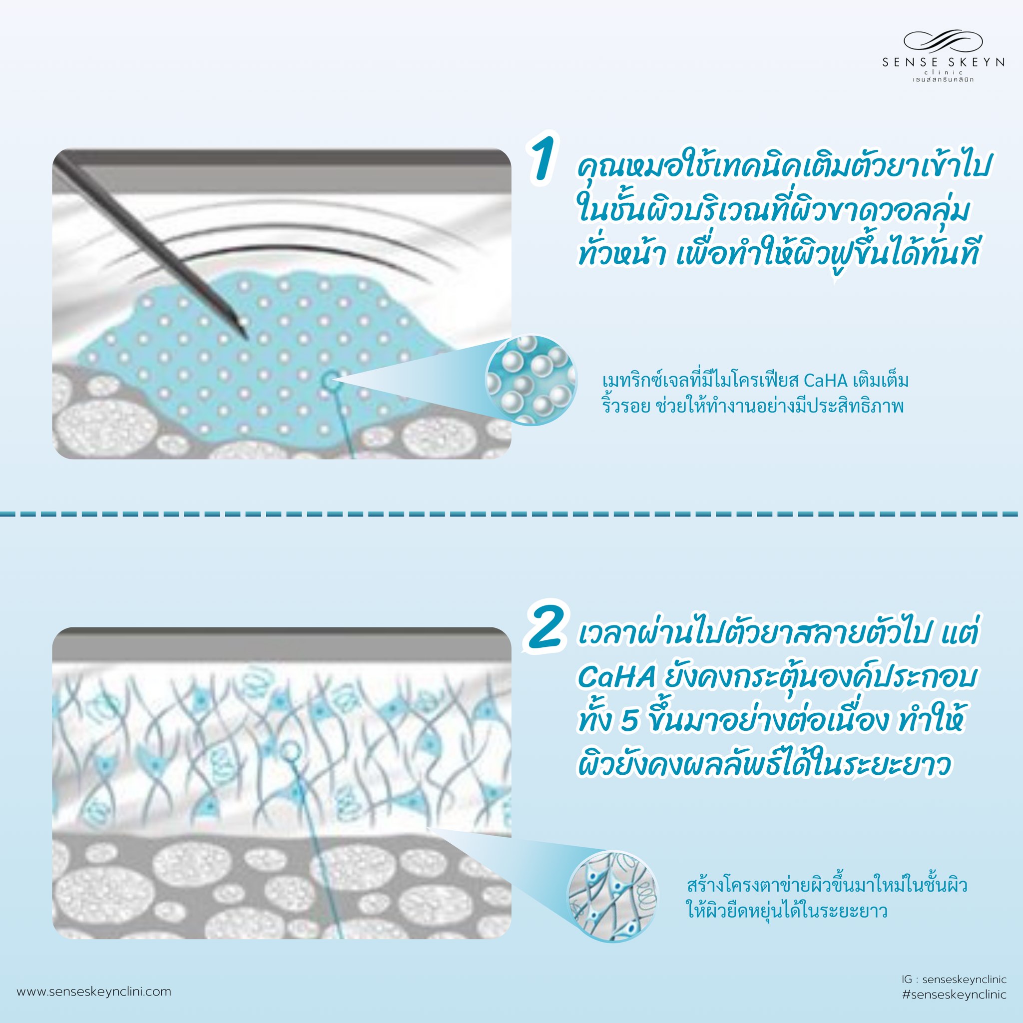 Sense Skeyn Clinic... - Sense Skeyn Clinic เซนส์สกรีนคลินิก