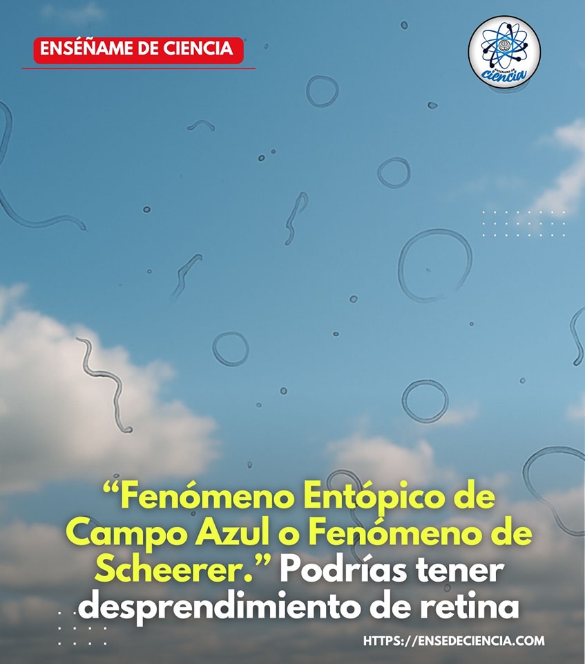 Enséñame - ¿Qué son esos puntos brillantes que aparecen cuando vemos al ...