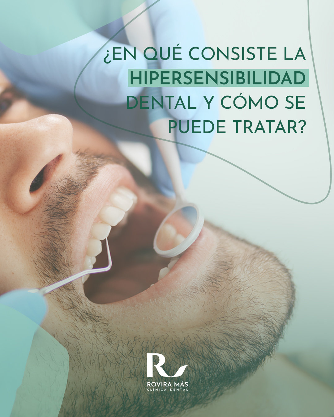 Rovira - ¿En qué consiste la hipersensibilidad dental y cómo se puede ...
