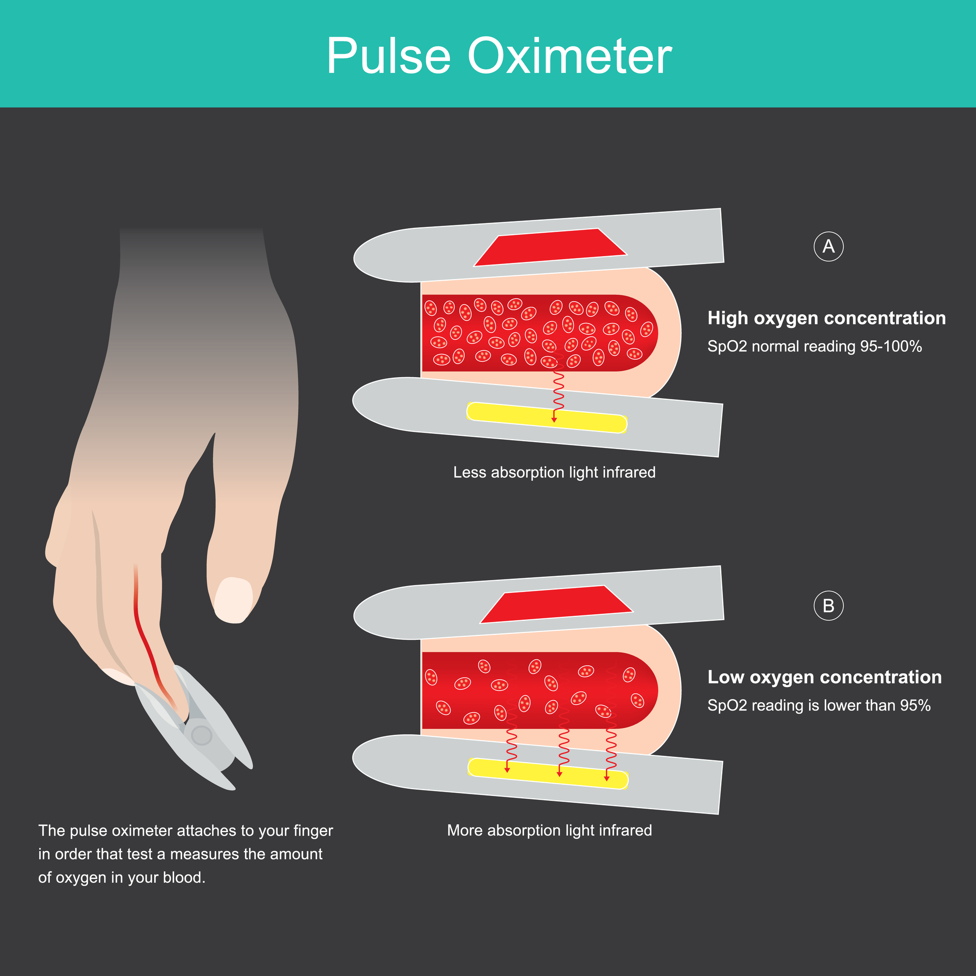 Respiratory - How a Pulse Oximeter Works | Facebook