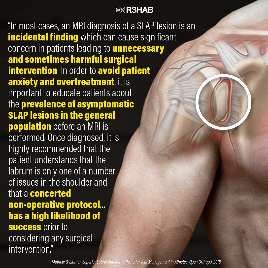 Has labrum surgery helped with shoulder injury?