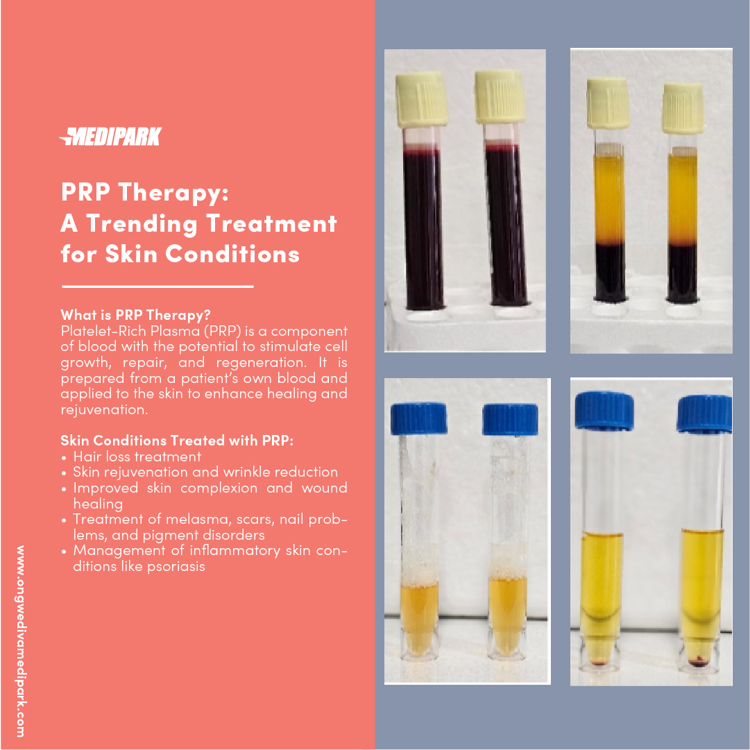 Ongwediva Medipark Hospital - Learn about PRP Therapy and its benefits ...