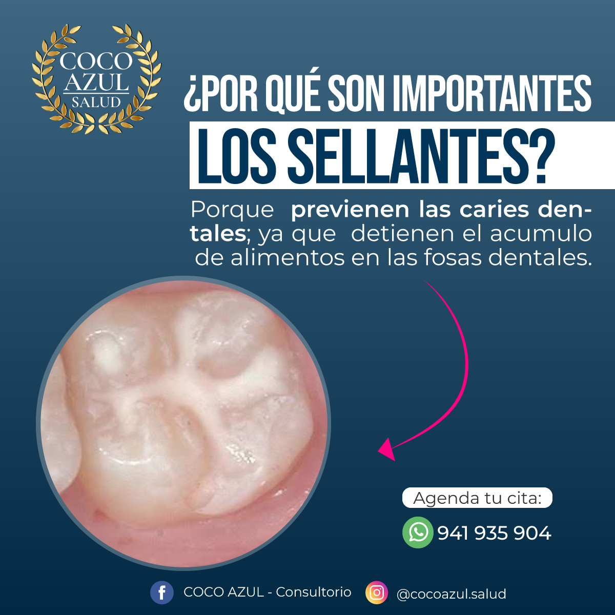 COCO AZUL SALUD - ⚠ Recuerda que los dientes con sellantes... | Facebook