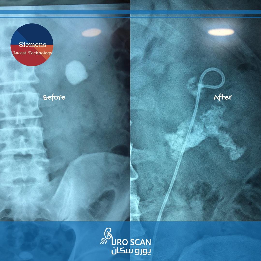 Uro Scan - مركز يورو سكان لتفتيت الحصوات و الأشعة | Cairo