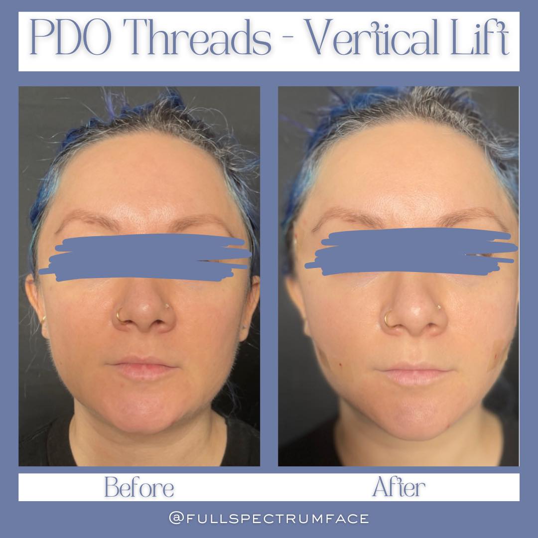 STUNNING vertical lift... - Full Spectrum Face + Body