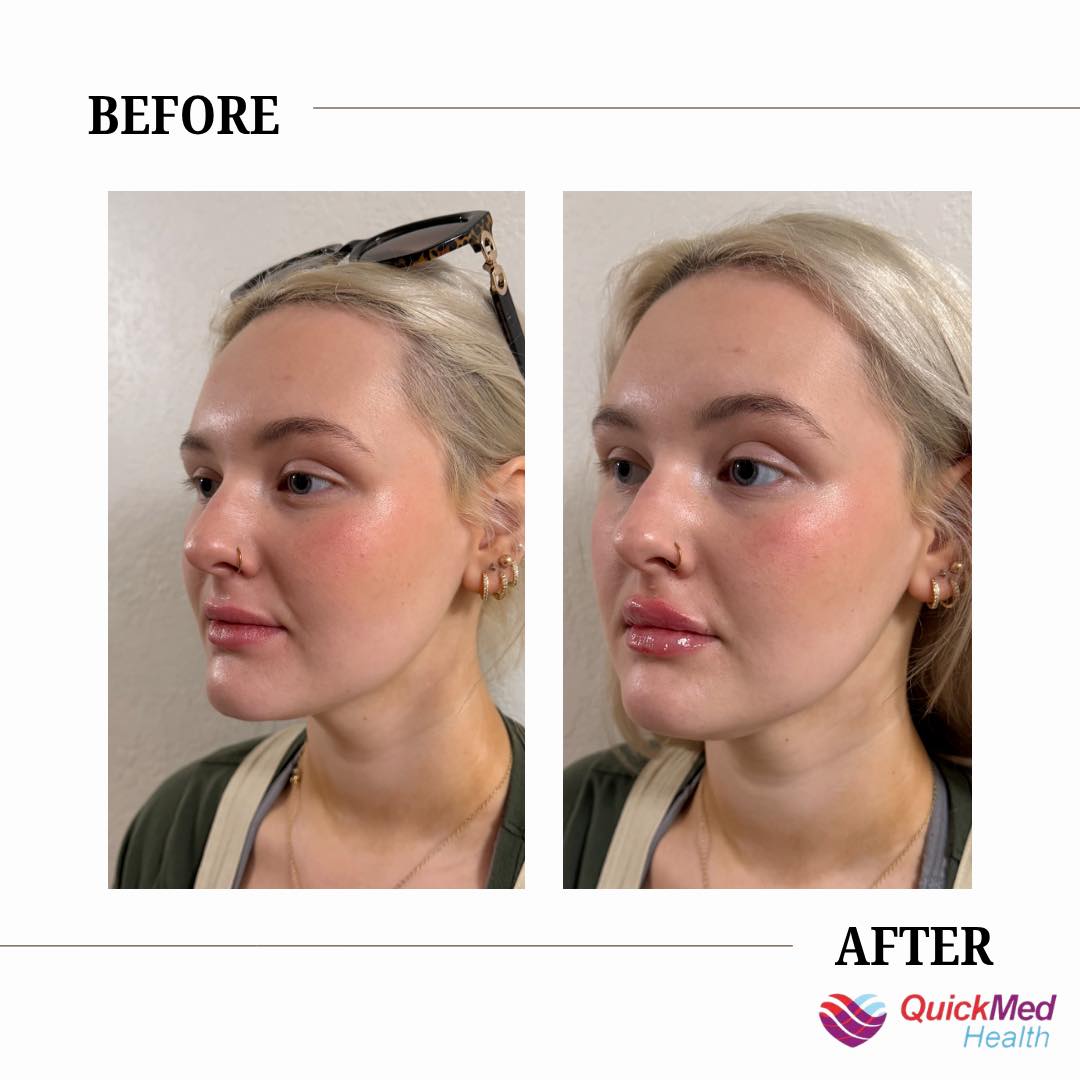 New at QuickMed Health! 🎉 Ever heard of KLOW + GLOW peptides and wondered what the hype is about? Let us break it down for you! 💧 KLOW Supports healthy skin, hair