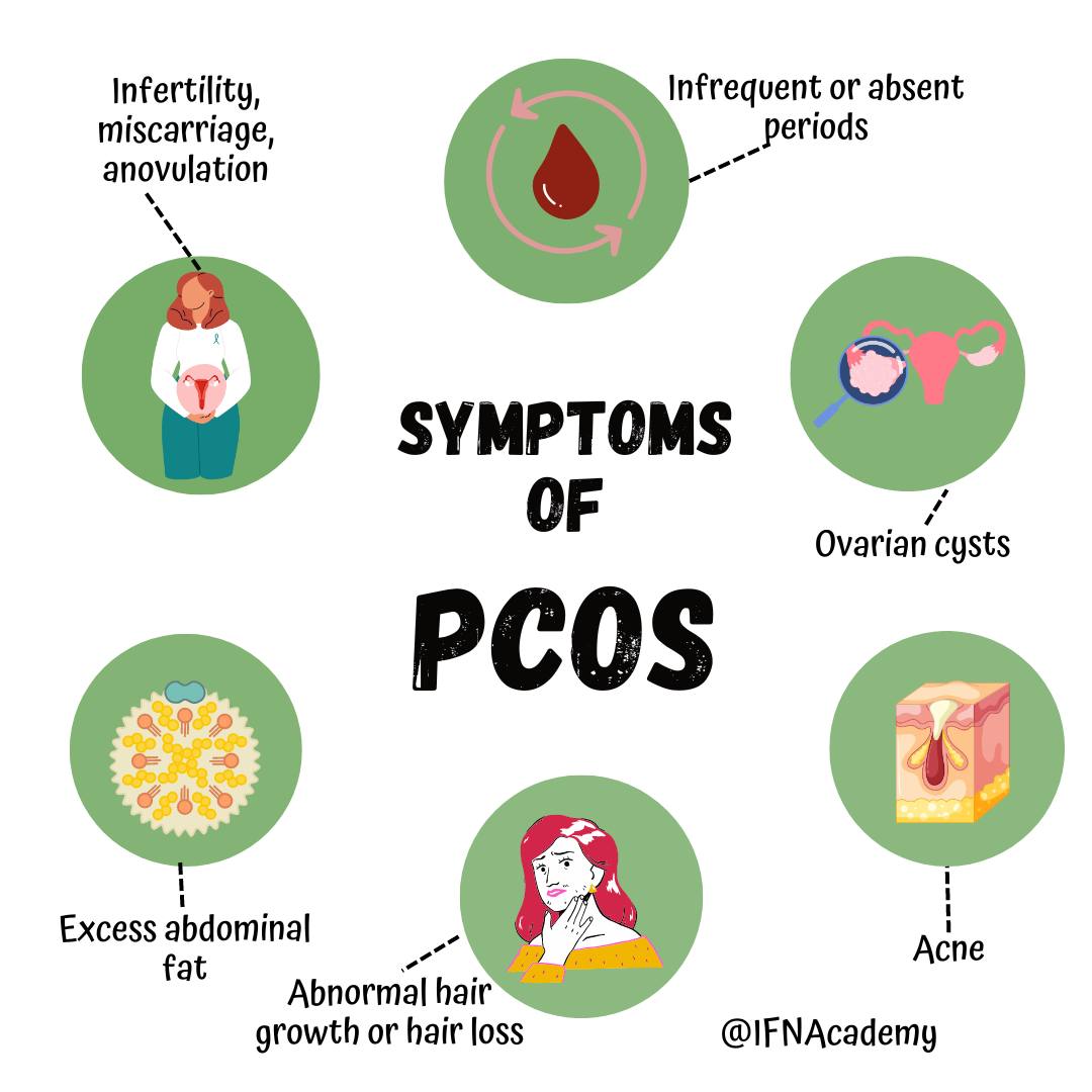 Integrative - Polycystic ovary syndrome, or PCOS, is a hormonal ...
