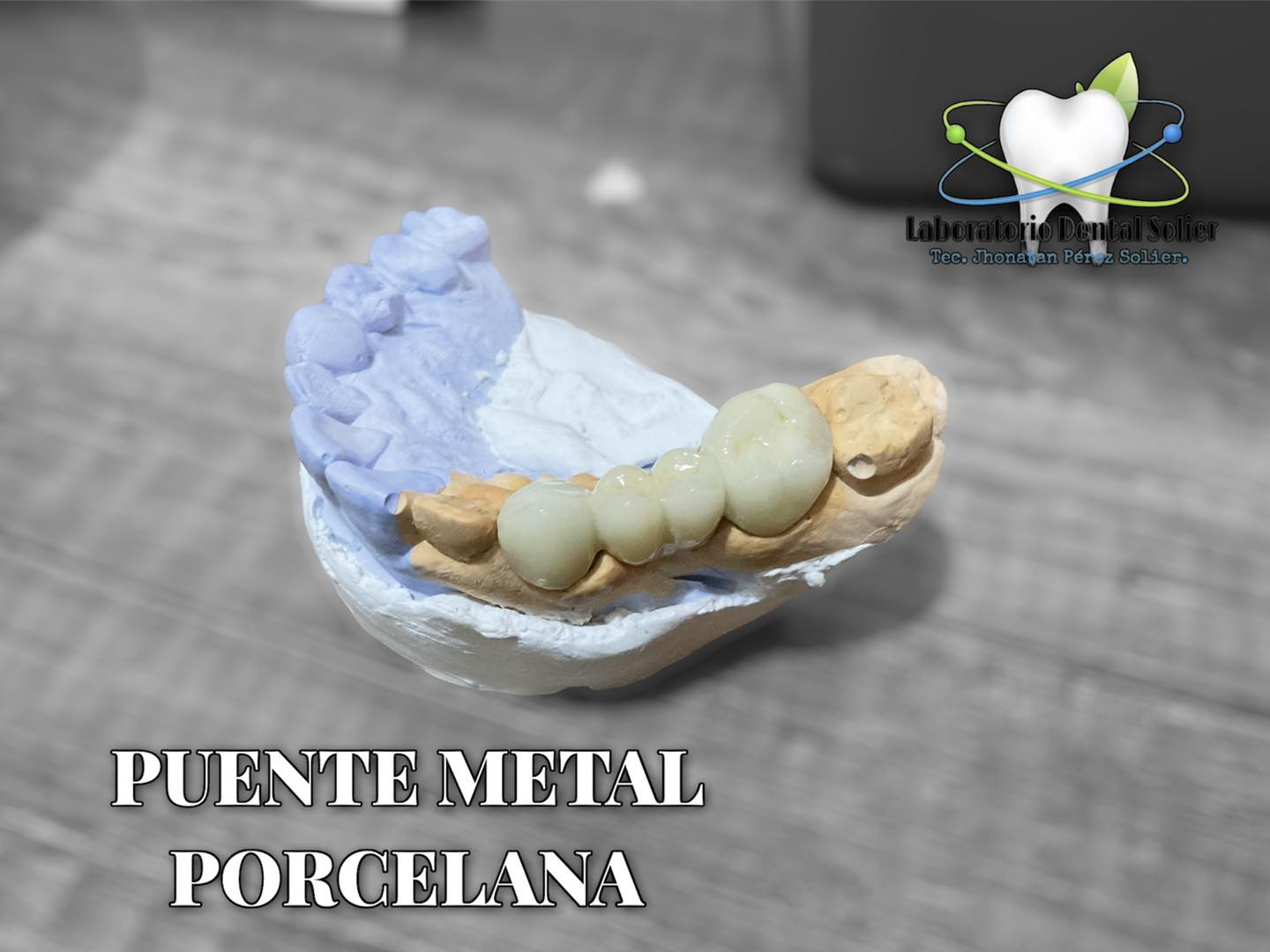 Laboratorio dental solier | Chiclayo