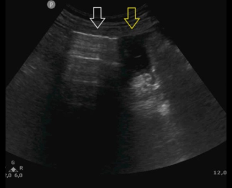 Australasian - 📖 This Sonography case demonstrates how “abdominal ...