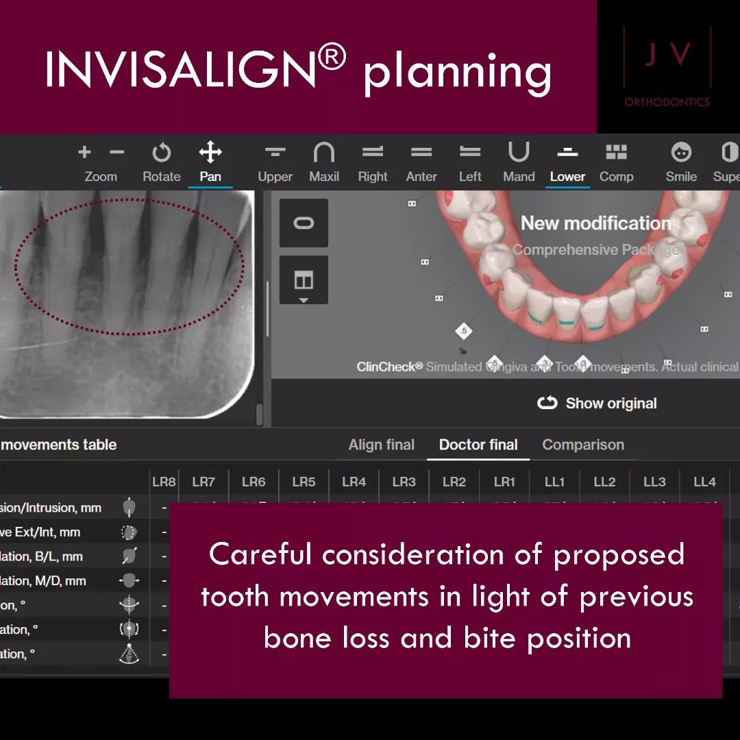 Dr. - 🔸️DETAILED PLANNING🔸️ One of my favourite features of the # ...