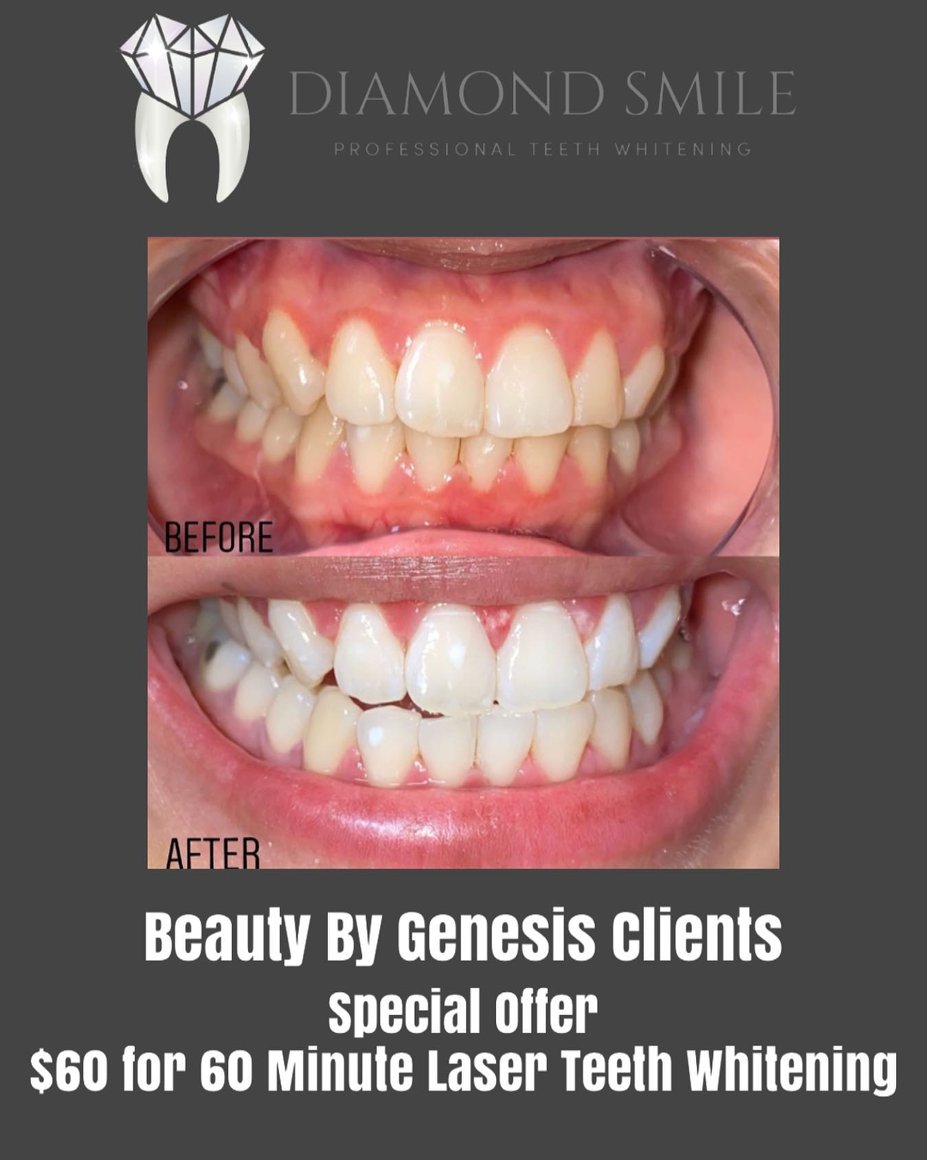 Diamond Smile | Delano CA