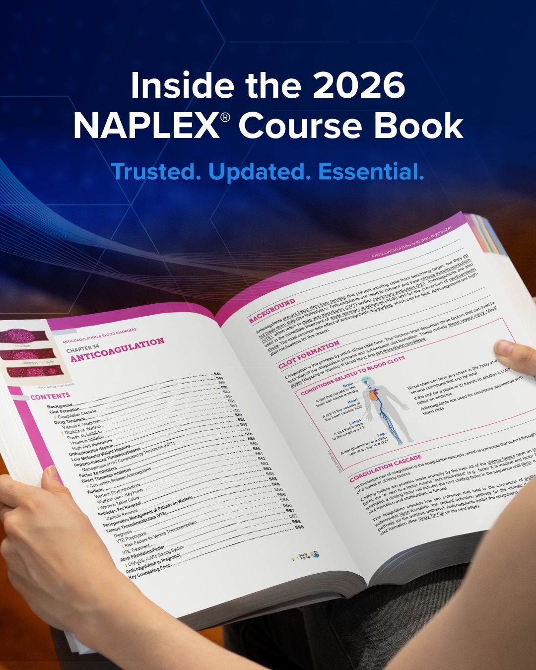 UWorld RxPrep - 🥳The 2026 UWorld RxPrep NAPLEX Course Book... | Facebook