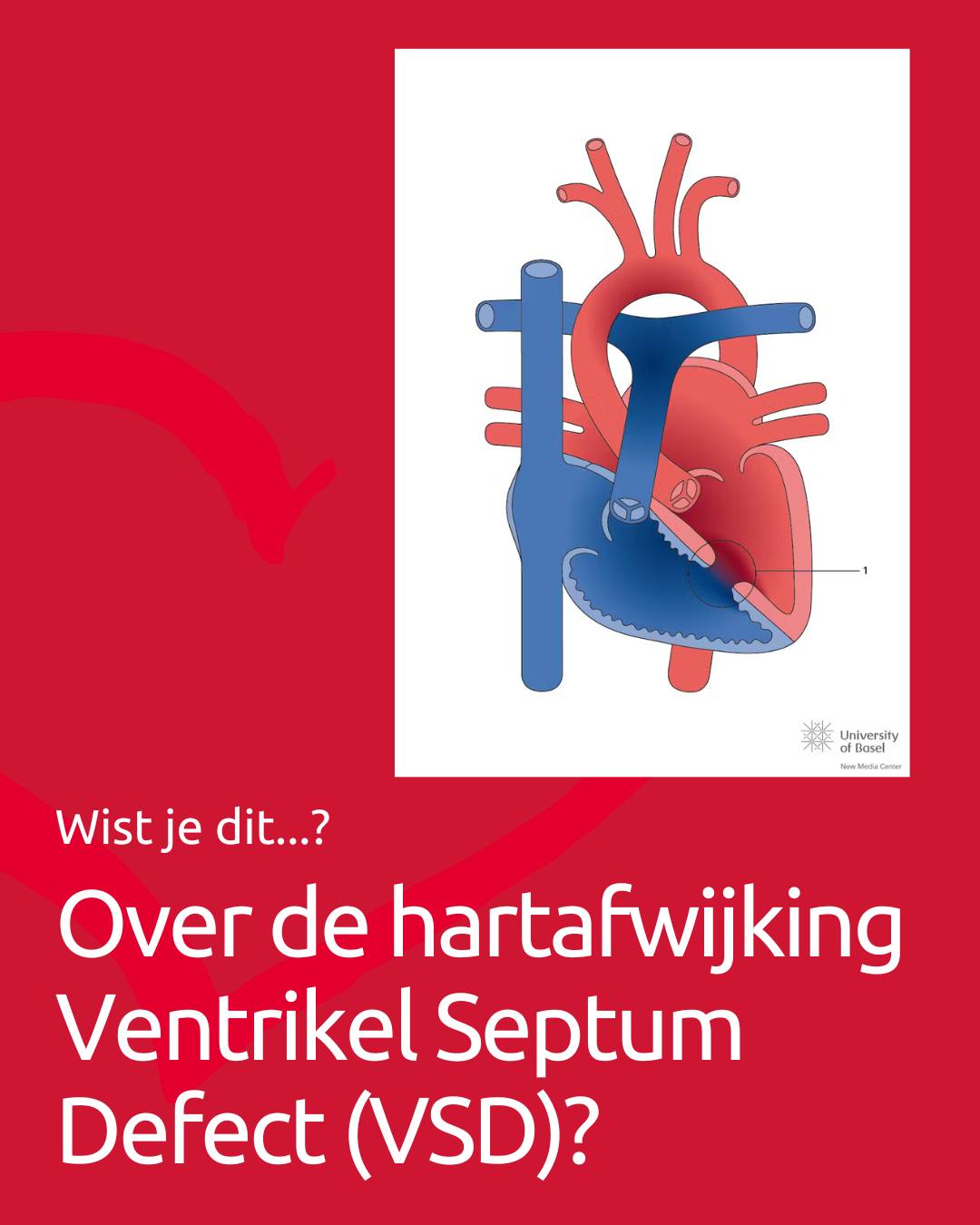 Stichting - 𝗪𝗶𝘀𝘁 𝗷𝗲 𝗱𝗶𝘁 𝗼𝘃𝗲𝗿 𝗱𝗲 𝗵𝗮𝗿𝘁𝗮𝗳𝘄𝗶𝗷𝗸𝗶𝗻𝗴 𝗩𝗲𝗻𝘁𝗿𝗶𝗸𝗲𝗹 𝗦𝗲𝗽𝘁𝘂𝗺 𝗗𝗲𝗳𝗲𝗰𝘁 ...