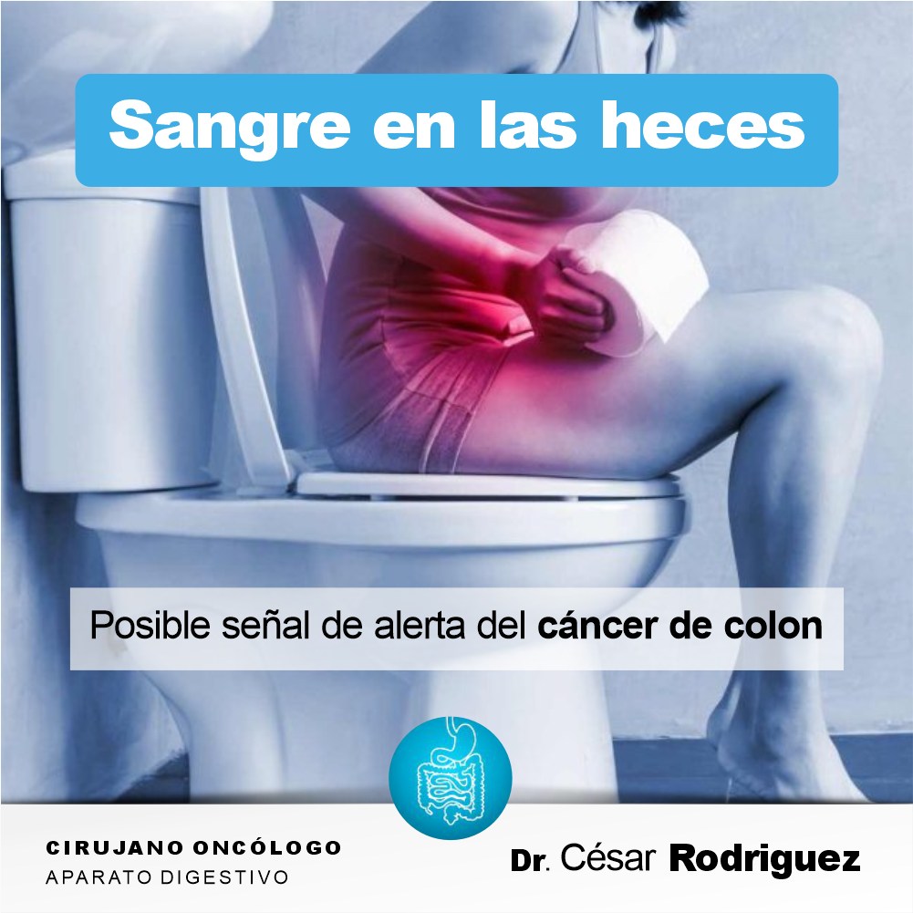 Dr. - 🔴 Sangre en las heces: Posible señal de alerta del Cáncer de ...