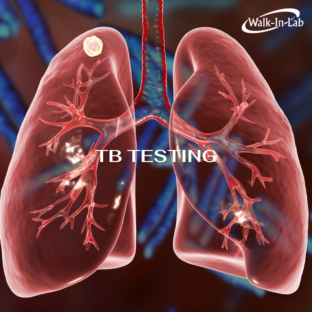 Walk-In Lab - 🩸 Why This Test Could Be a Lifesaver 🩸...