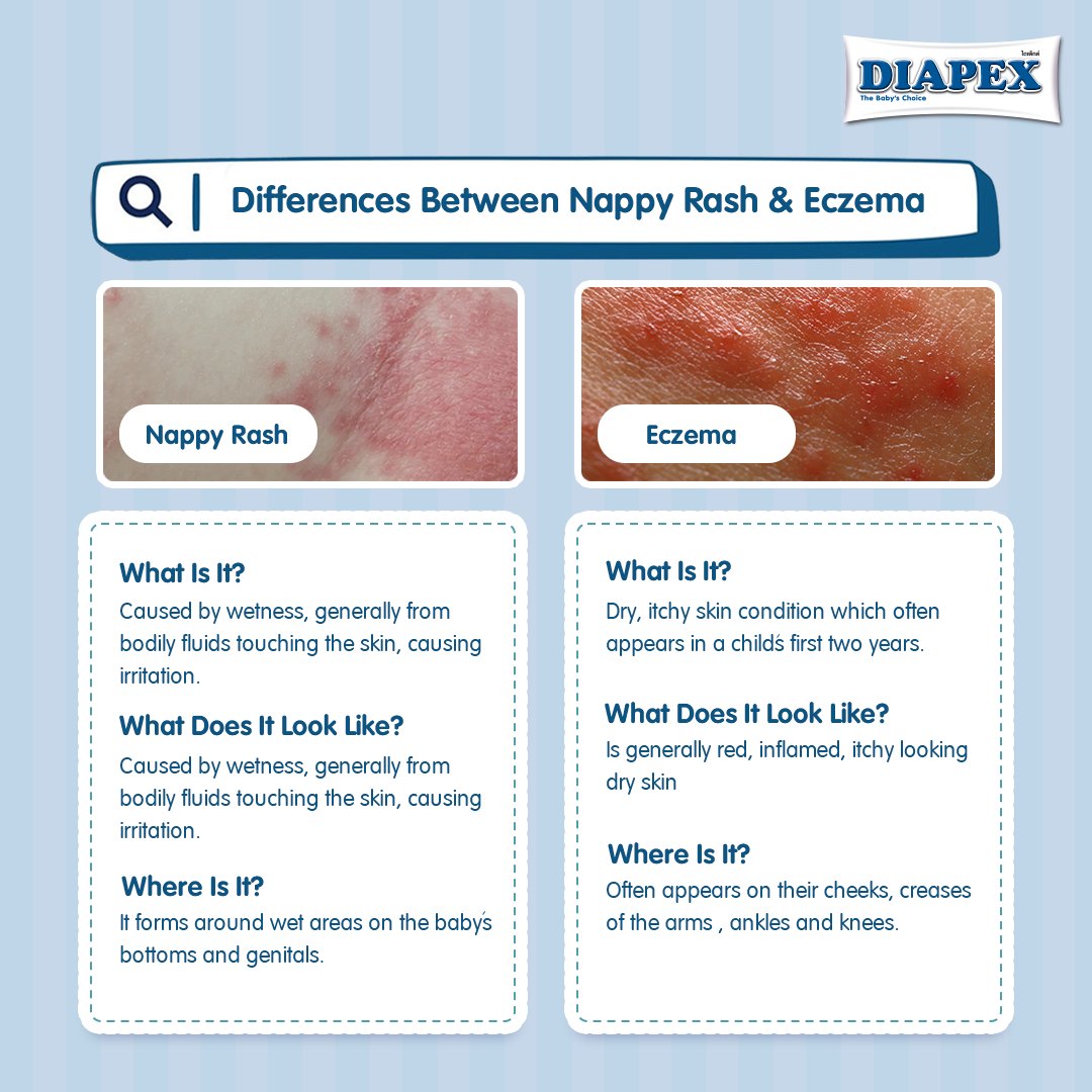 Diapex - Toddlers and babies can often get a wide range of skin ...
