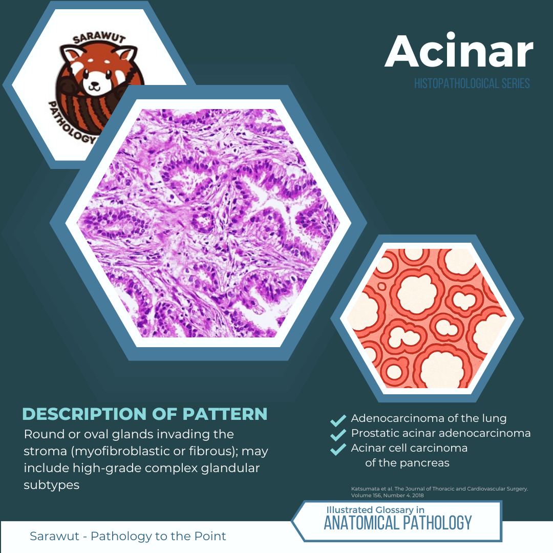 Sarawut - Pathology to the Point - ⭐ Illustrated Glossary in ...