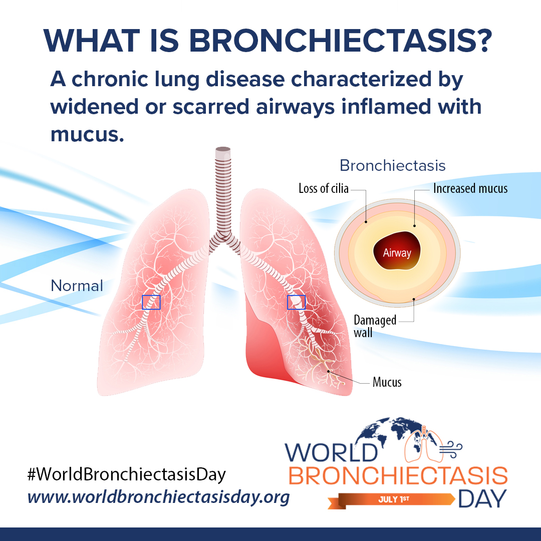 Trouble clearing mucus from your lungs? It could be bronchiectasis. With the right care, you can still stay active. Learn more at lung.org/ bronchiectasis #bronchiectasis #chronicillness