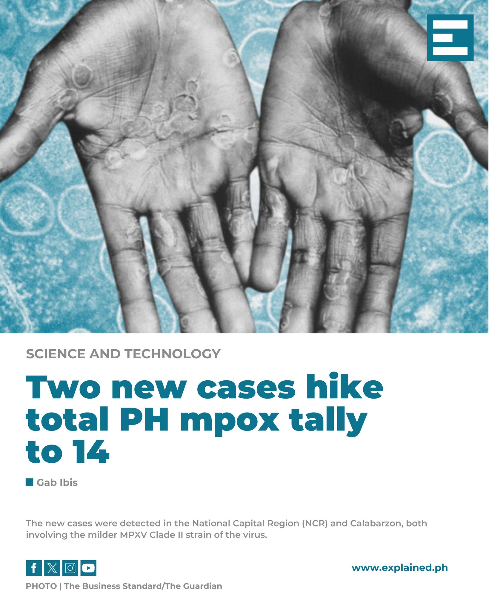 Explained PH - The Department of Health (DOH) reported two...