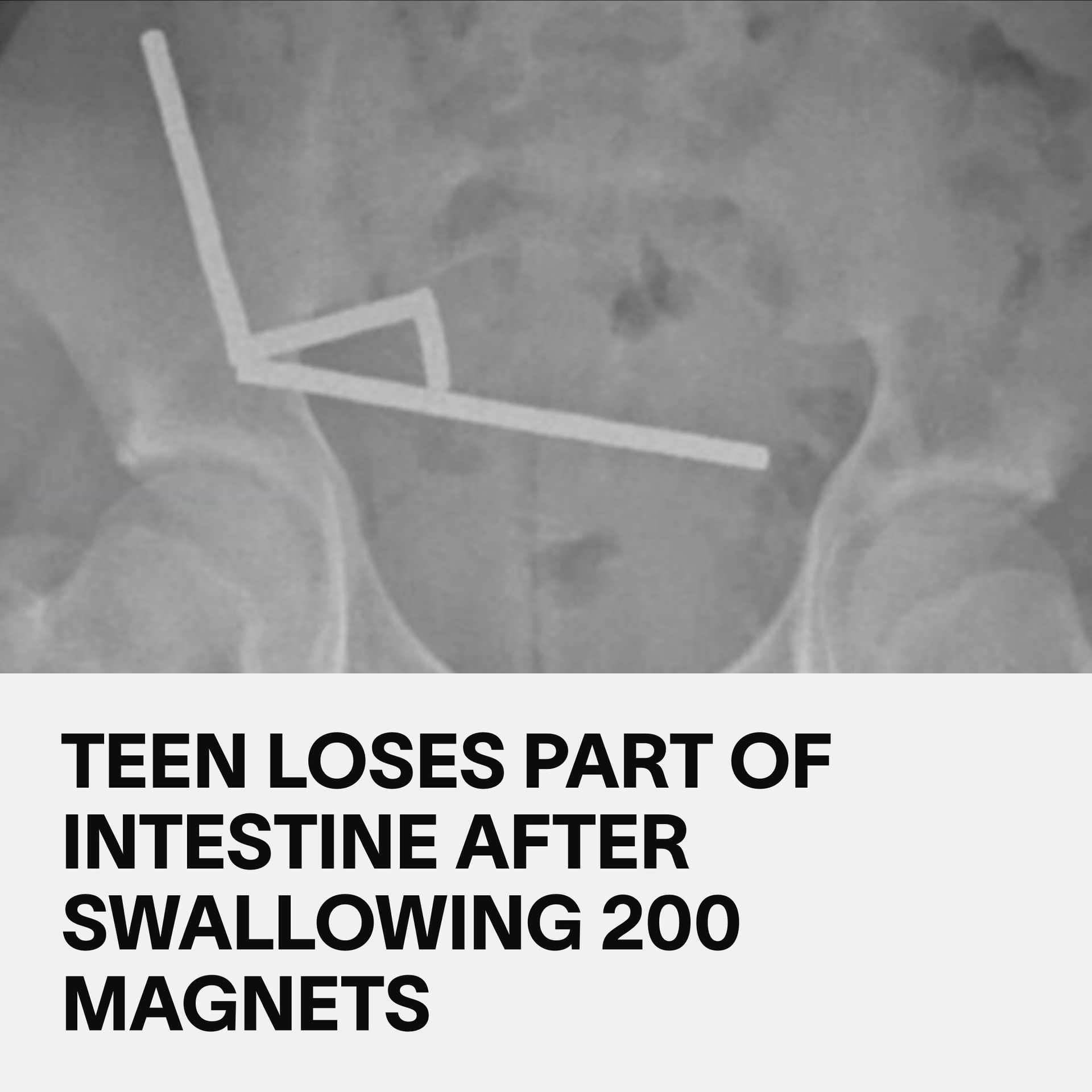 VICE Health - A 13-year-old in New Zealand recently had to... | Facebook