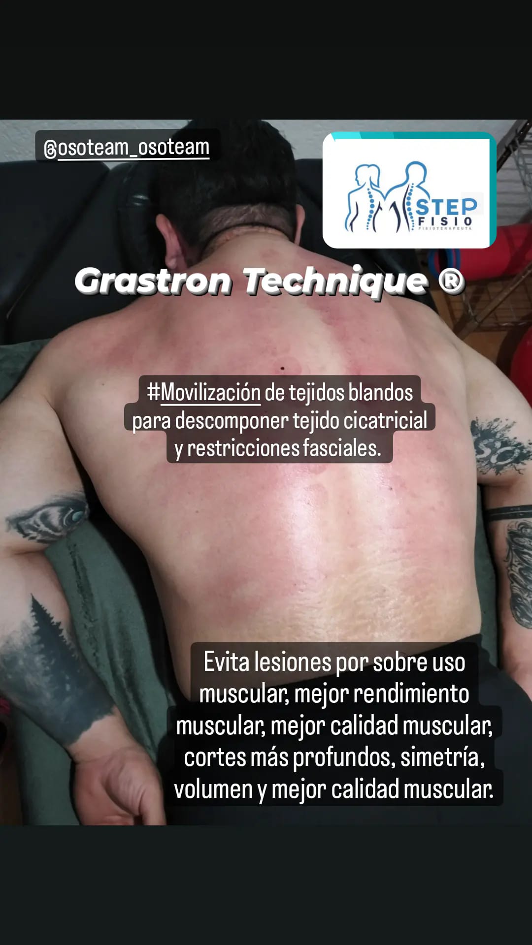 FISIO STEP | Toluca