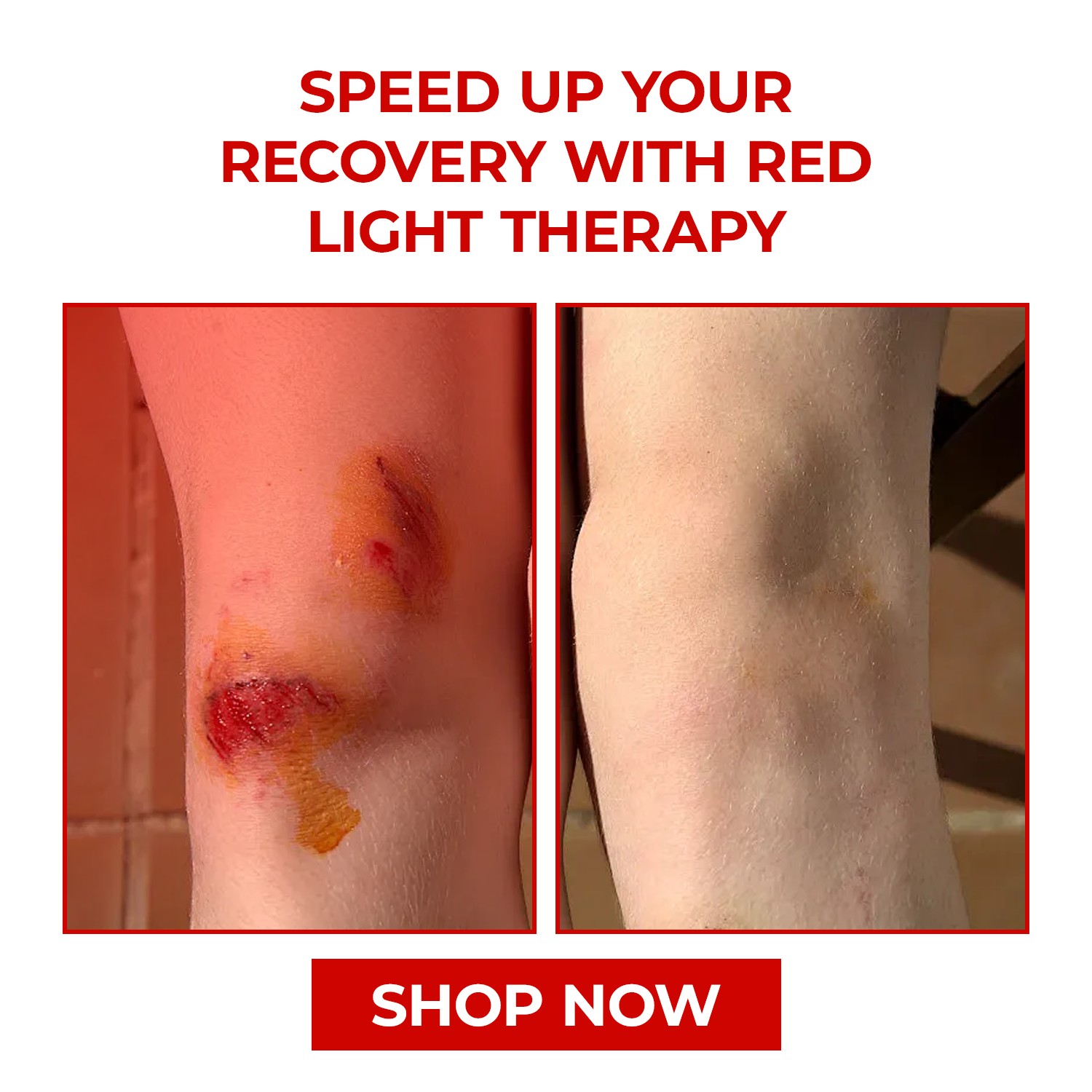 Megelin - Red Light Therapy: Beyond the Treatment Area Red light ...