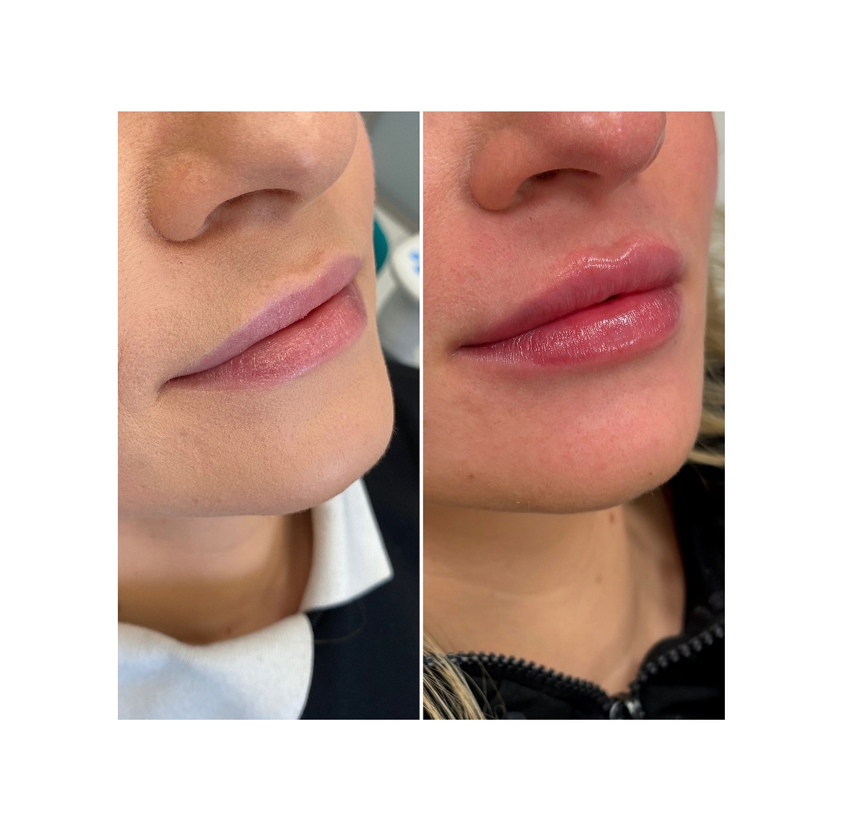 Dental Duo | Rijeka