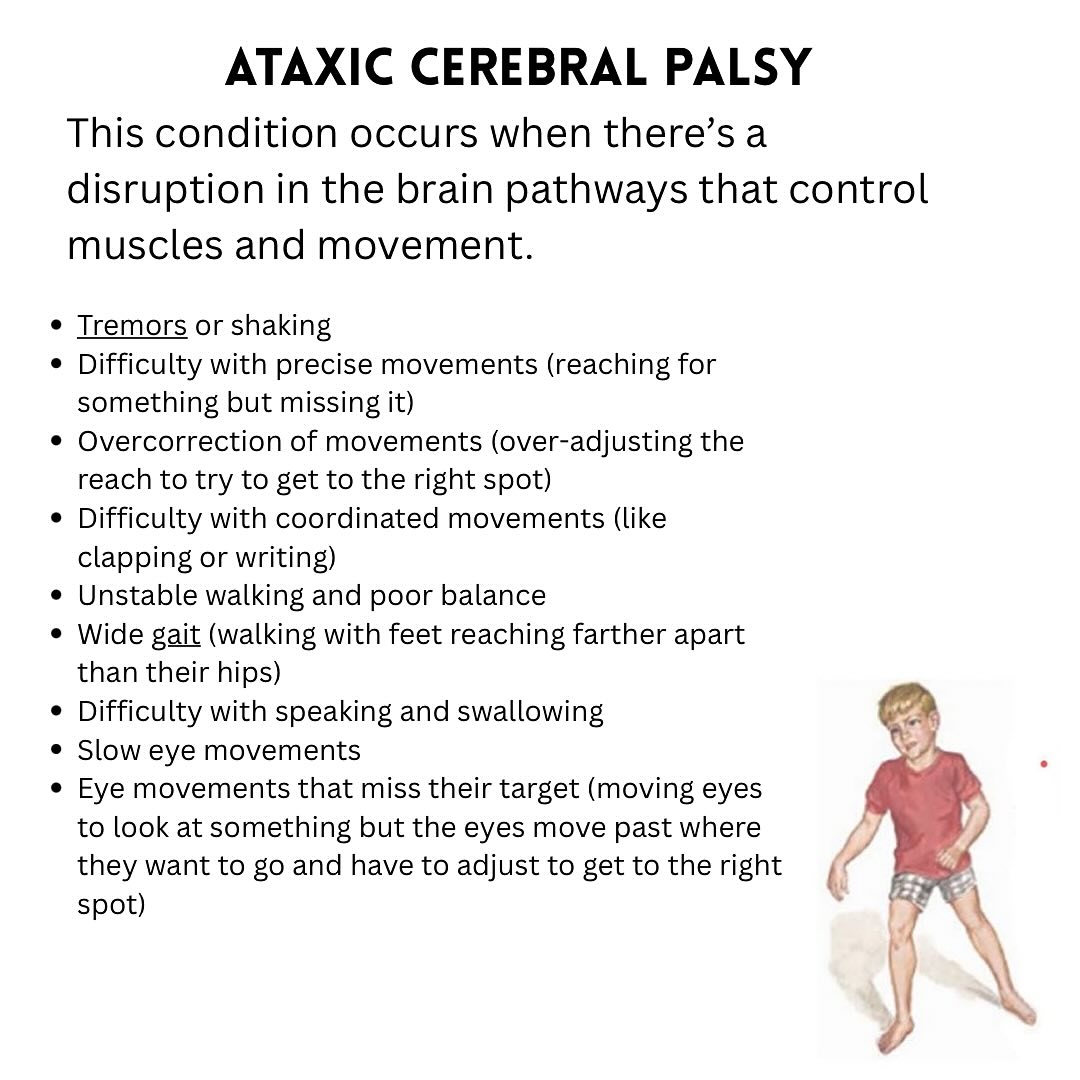 Active - Spastic cerebral palsy is the type of cerebral palsy ...