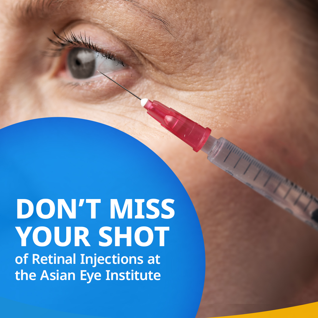 Asian Eye Institute | Makati