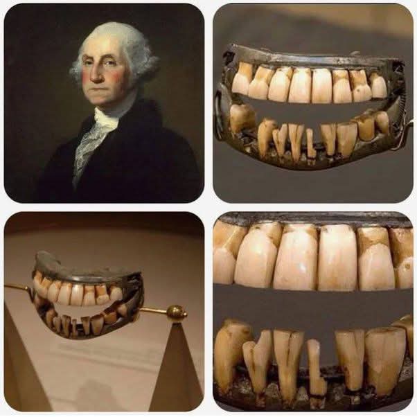 Beauty - By age 20, George Washington suffered serious dental decay ...