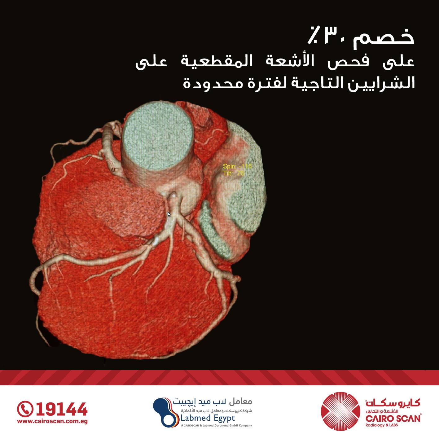 الفحص مخصص لتصوير الشرايين... - Cairo Scan Radiology&Labs