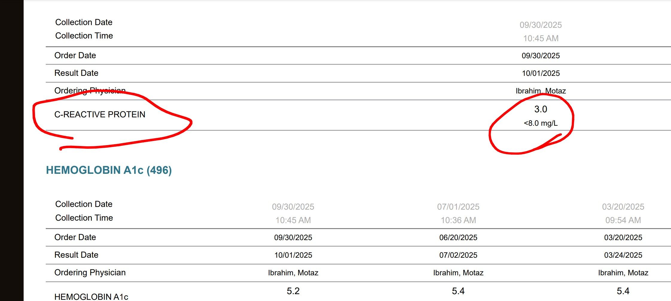 glutathione oxidized reduced ratio brain Transsulfuration pathway activation attenuates oxidative stress and ferroptosis in sickle primary erythroblasts and transgenic mice water test strips The 5 Best Water Injection(s):Single