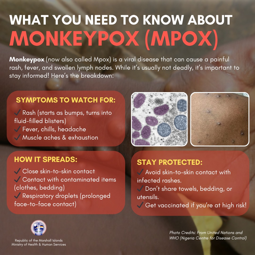 MPOX... - RMI Ministry of Health and Human services | Facebook