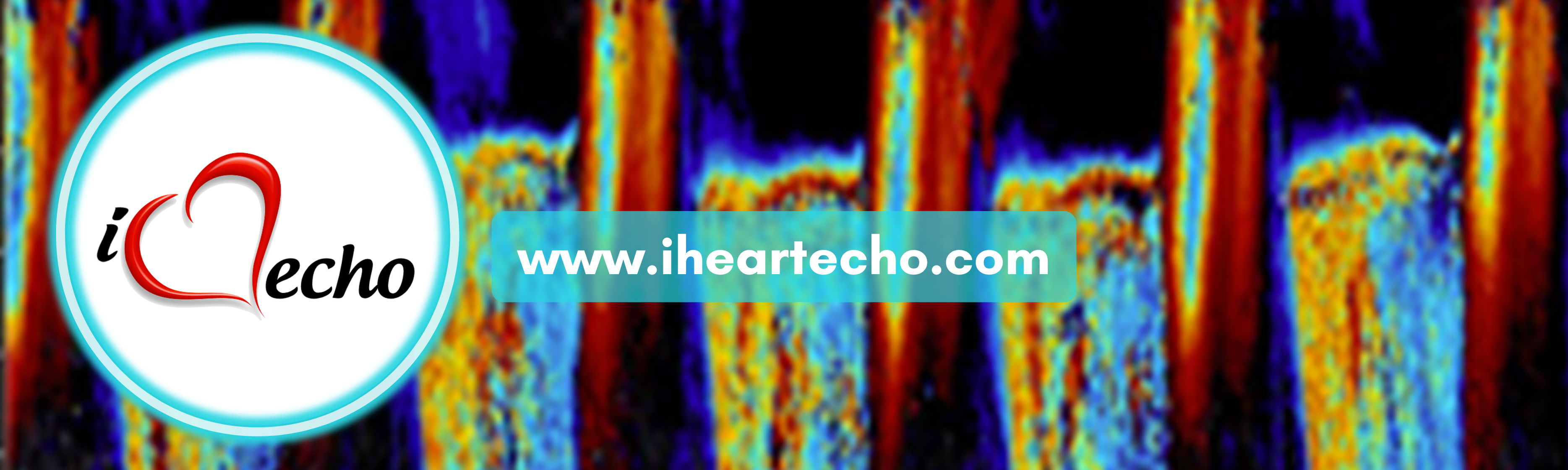 ECGWeekly - A 76-year-old man presents with chest pain... | Facebook