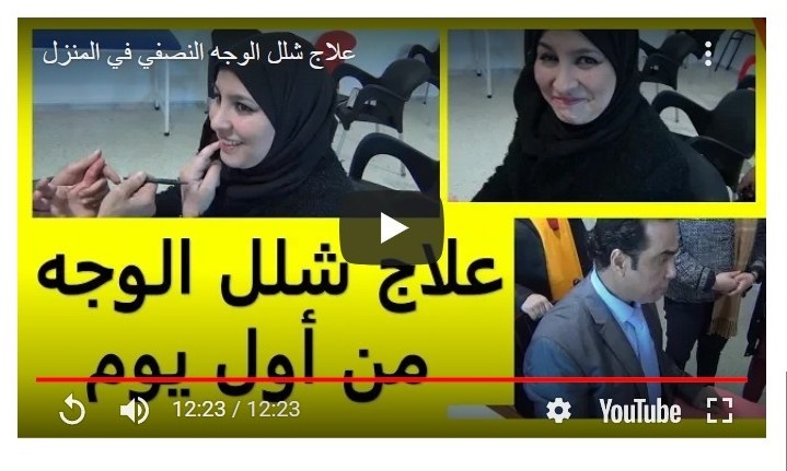 صفحة العلاج الذاتي على الفيسبوك السلام عليكم طريقة علاج شلل الوجه النصفي في المنزل الوسيلة تساهم بعلاج الحالات التالية شلل الوجه النصفي شلل الوجه العصبي شلل الوجه العصب السابع شلل الوجه