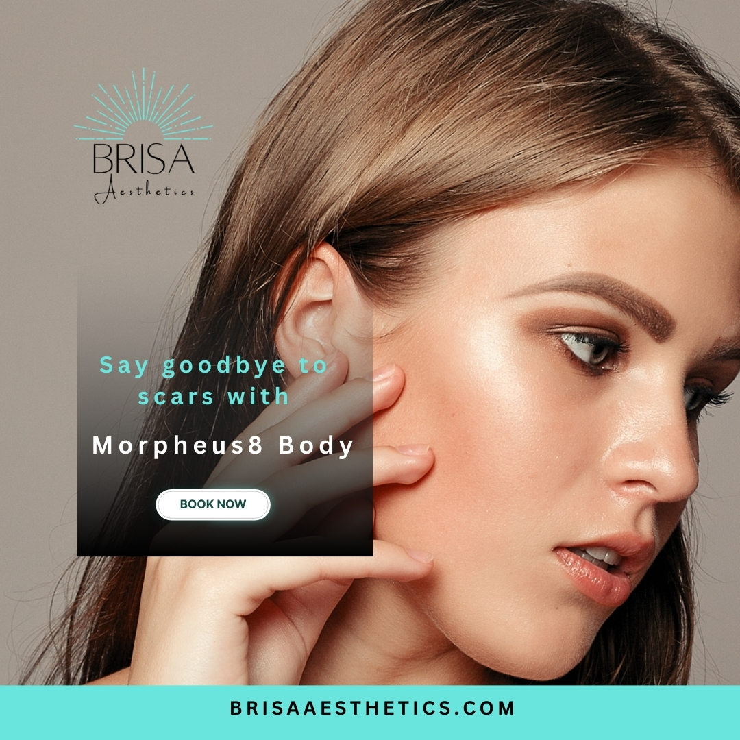 Brisa - Say goodbye to scar insecurities with Morpheus8 Body at Brisa ...