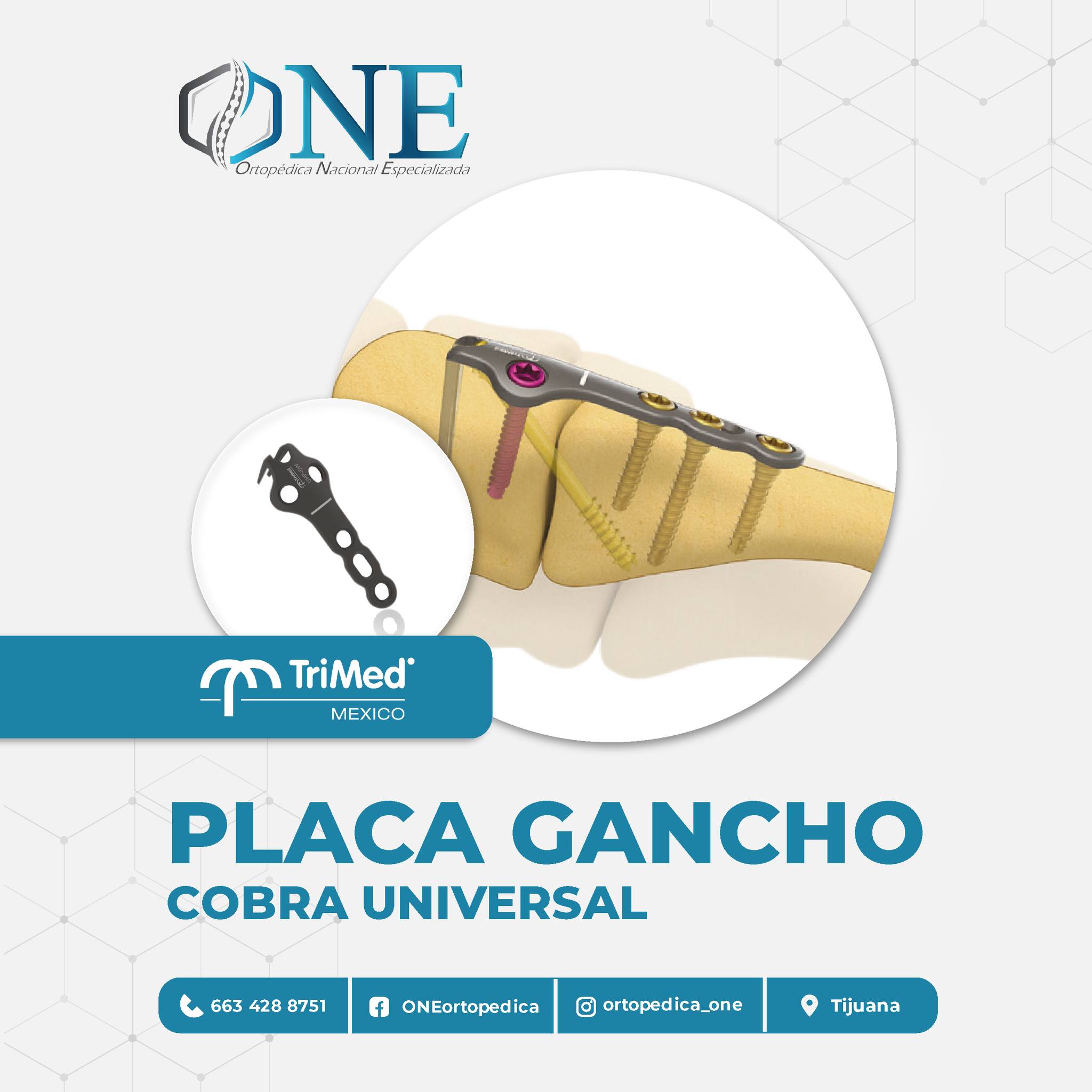 Ortopédica - Placa Gancho Cobra Universal Placa de alta utilidad con ...