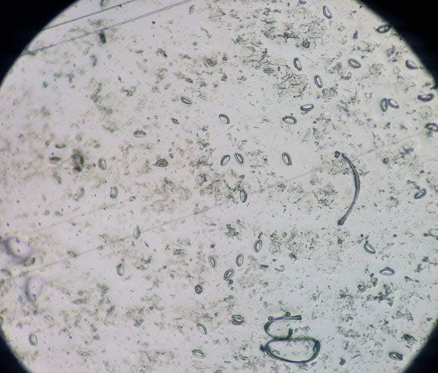 El Test de Graham es un método... - Microbiologia Medica | Facebook
