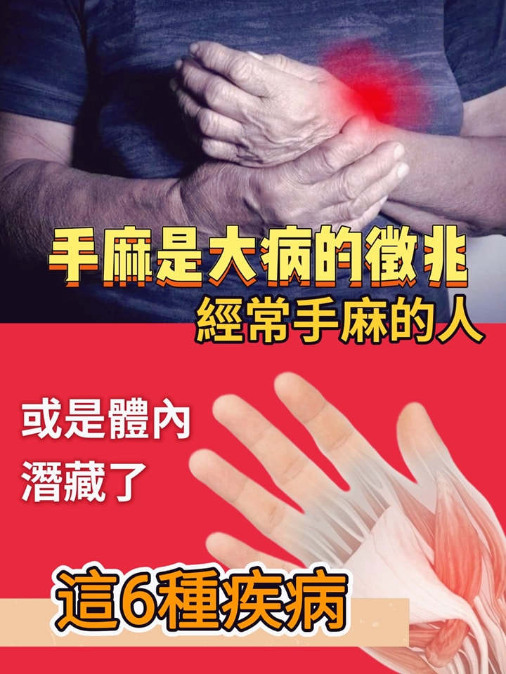 生活你最懂 - 手麻是大病的徵兆， 經常手麻的人， 或是體內潛藏了這6種疾病 | Facebook