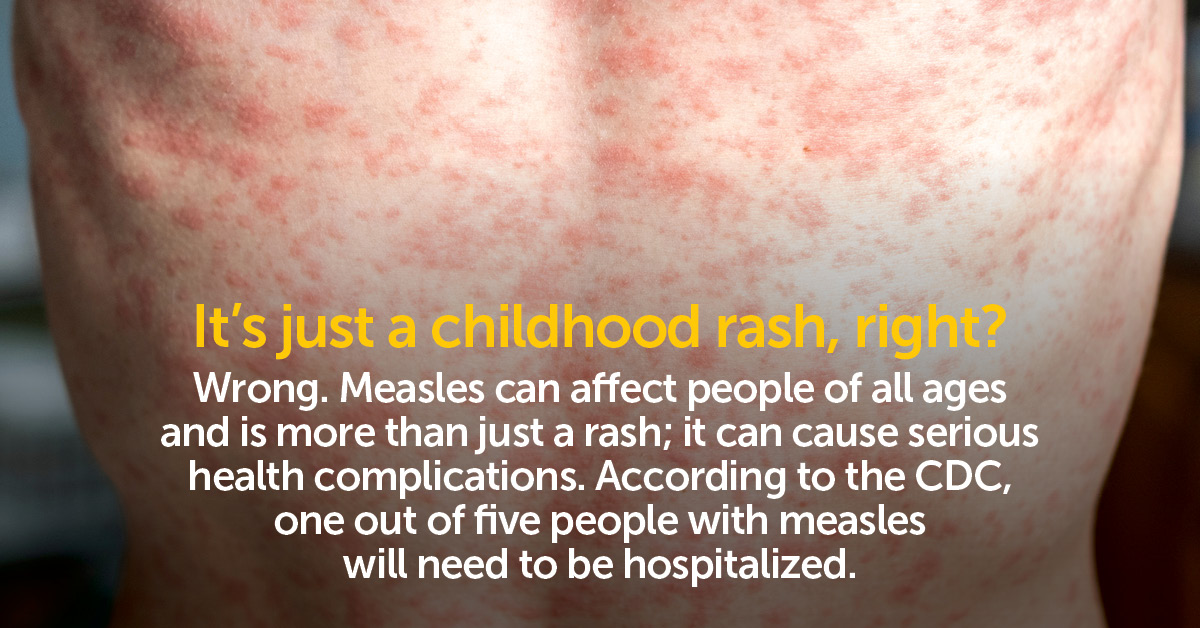 Summa Health - Measles is highly contagious – one infected... | Facebook