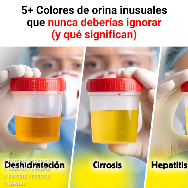Genial - Desde el ámbar oscuro al azul chillón, el color de la orina ...