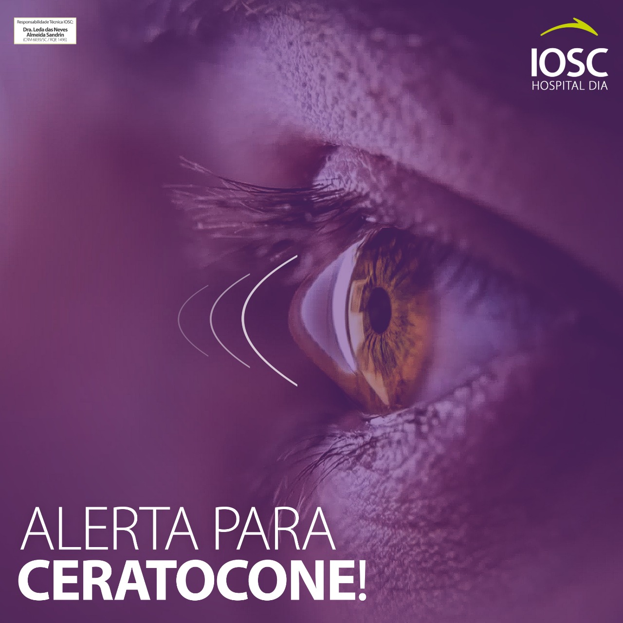 IOSC - Saúde Ocular: Sente coceira nos olhos? Identifique...