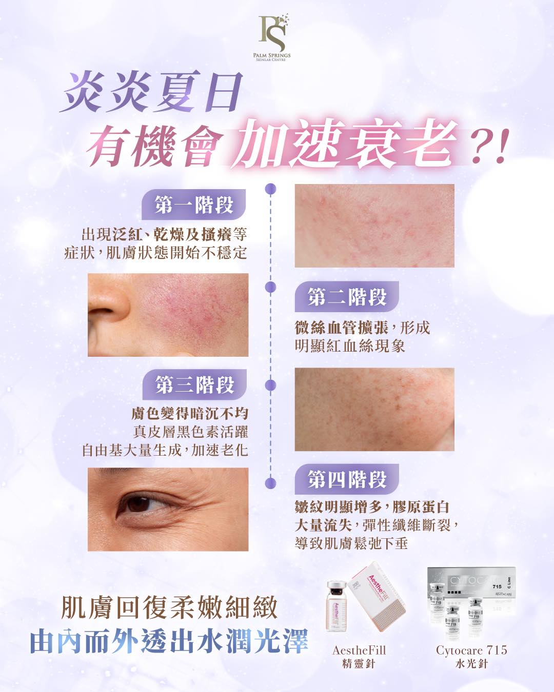 Palm - ☀️夏日炎症=初老警號？！ 長期日曬、高溫、油水失衡，會引發微炎症反應！😨 令血管擴張、膠原流失、色素沉澱…… ⌛️ 你以為係 ...