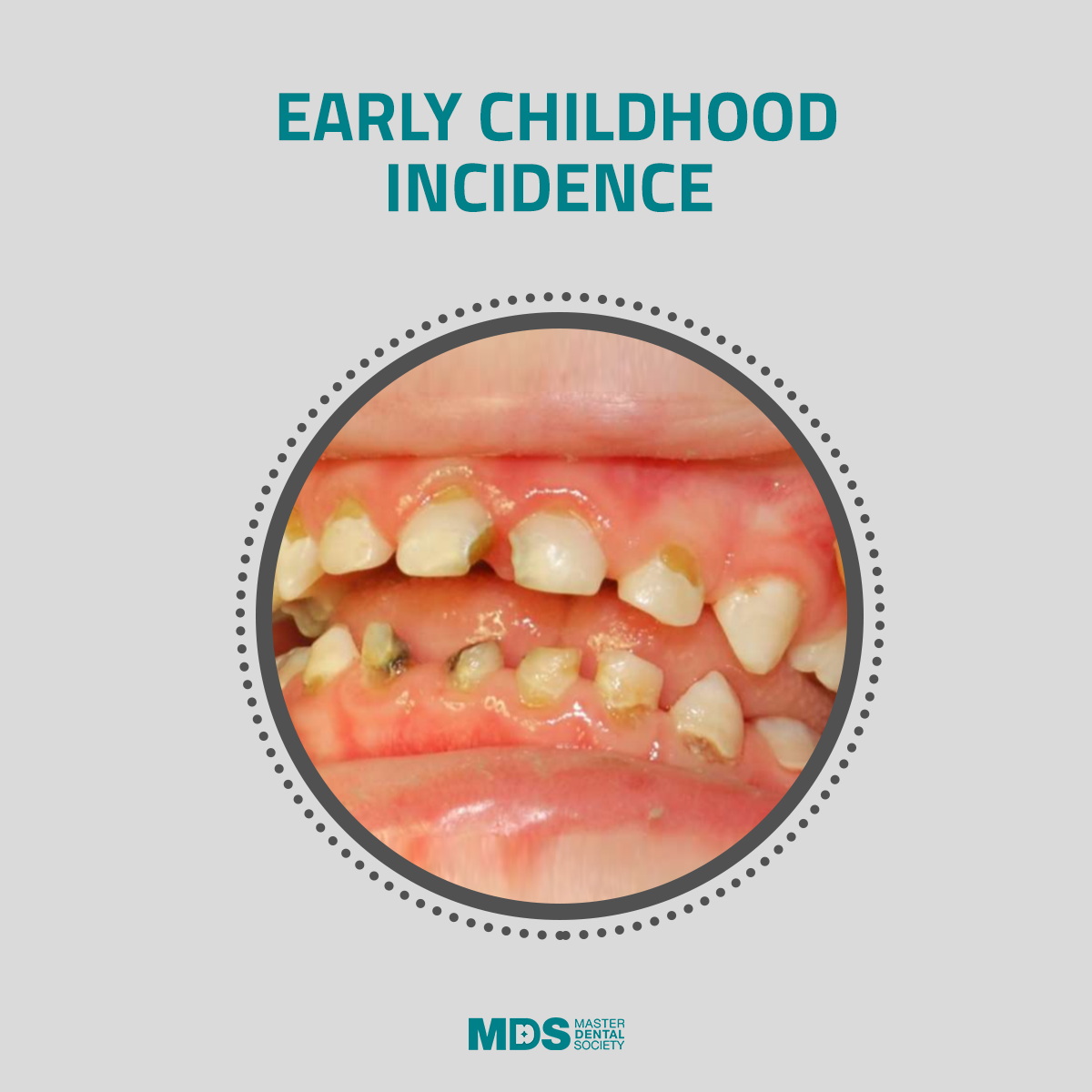 موضوع مهم جدا في البيدو... - Master Dental Society- MDS | Facebook