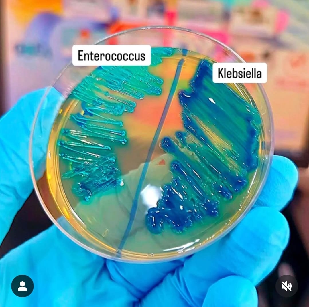 Microbiologia - En CHROMagar, Klebsiella (a la derecha) forma colonias ...